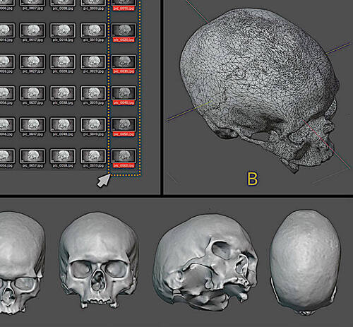 Forensic Facial Reconstruction of the Mladeč I Skull